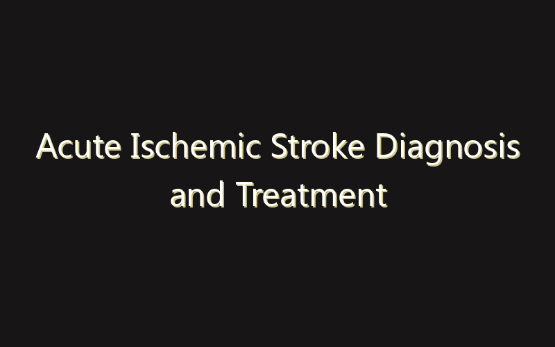 Acute Ischemic Stroke Diagnosis and Treatment Market:Size, Share, Scope And Forecast 2035