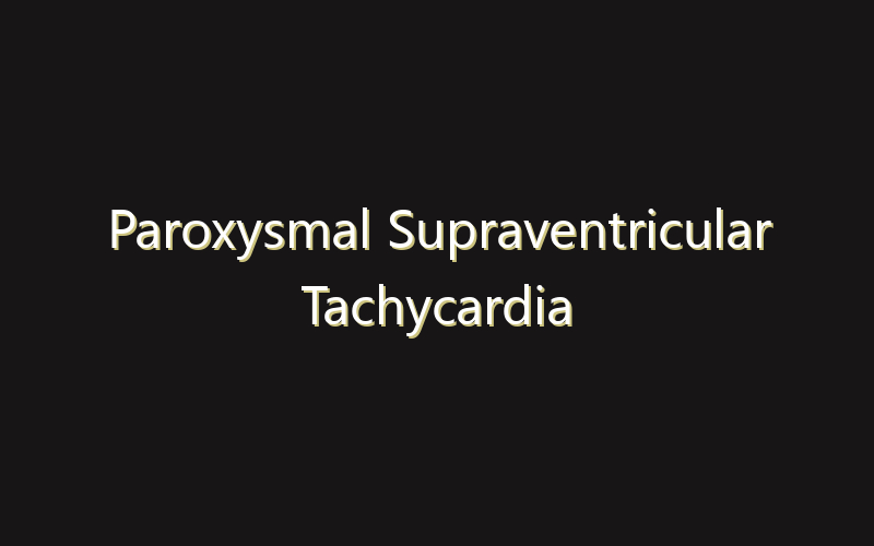 Paroxysmal Supraventricular Tachycardia Market:Size, Share, Scope And Forecast 2035